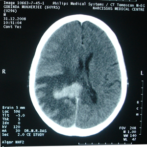 C.T.Scan of Brain dated 31.12.2008